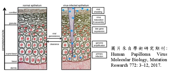 HPV Pathogenesis Diagram